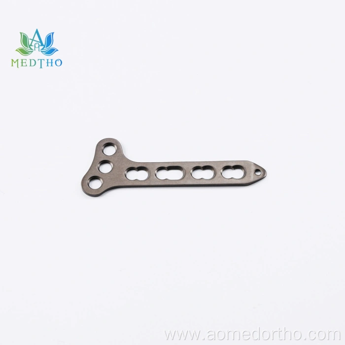 distal radius plate